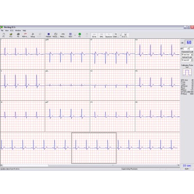 Norav 1200M PC Rust ECG, per stuk