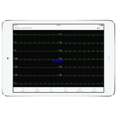 PAD ECG met interpretatie