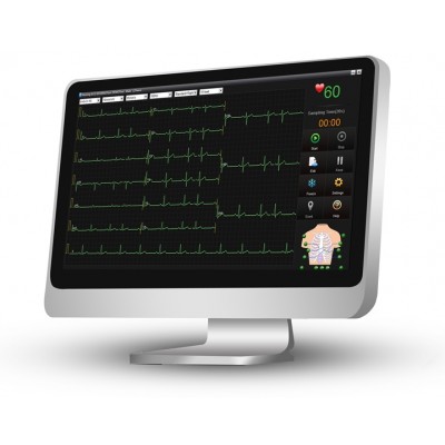 SE-1515 PC ECG met interpretatie