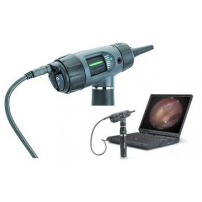 Welch Allyn digitale MacroView Video Otoscoop