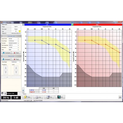 PC Screening Audiometer